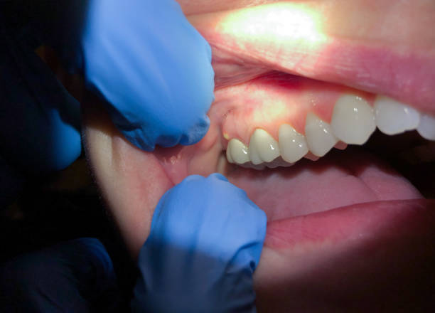Best Same-Day Emergency Dental Services in Gorevle, IL